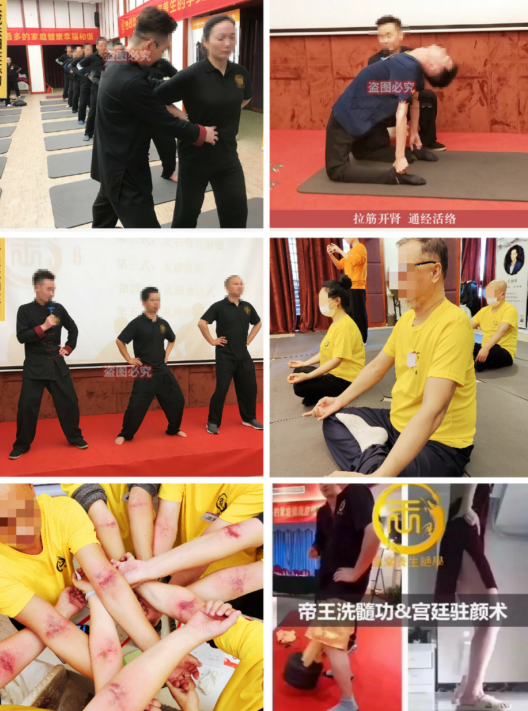 洗髓功的正确练法(男子洗髓功睾丸怎么绑)