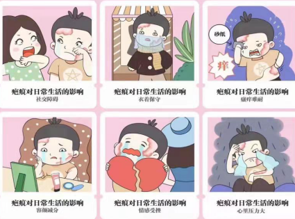 同济堂疤痕修复,疤痕对我们的生活有影响
